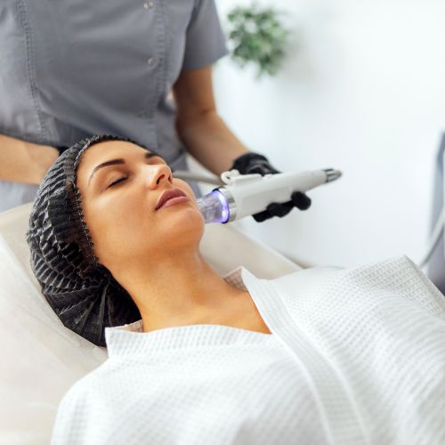 Microneedling en Zaragoza